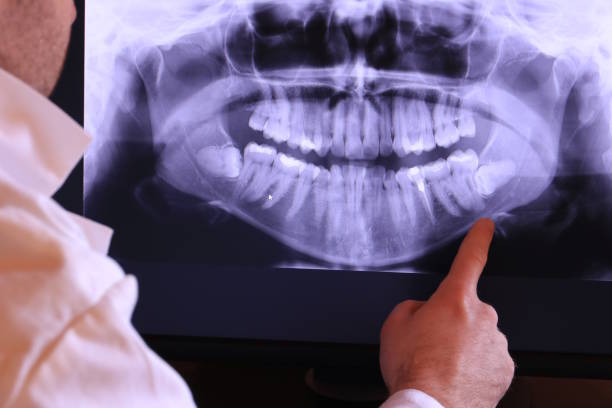 Best Root Canal Emergency Dentist  in Ortonville, MN